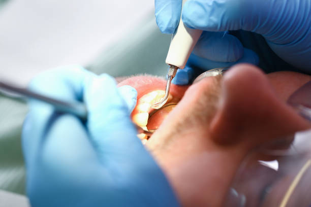 Best Tooth Infection Emergency Dentist  in Clay, CA