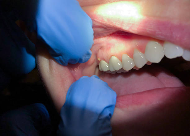 Best 24-Hour Emergency Dentist  in Clay, CA