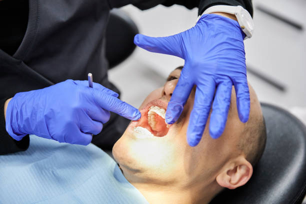 Best Cracked Tooth Emergency Dentist  in Clay, CA